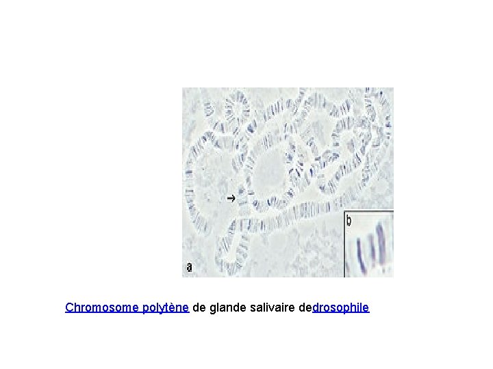 Chromosome polytène de glande salivaire dedrosophile 