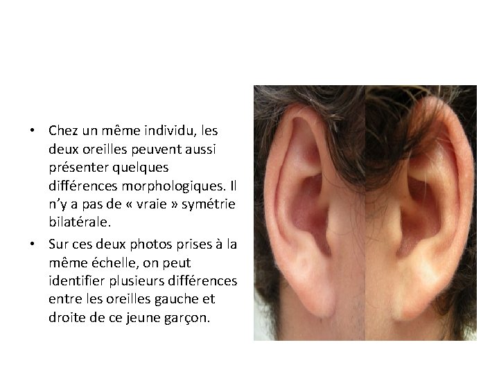  • Chez un même individu, les deux oreilles peuvent aussi présenter quelques différences