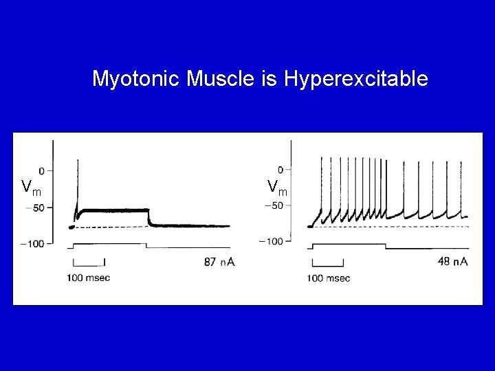 Myotonic Muscle is Hyperexcitable Vm Vm 