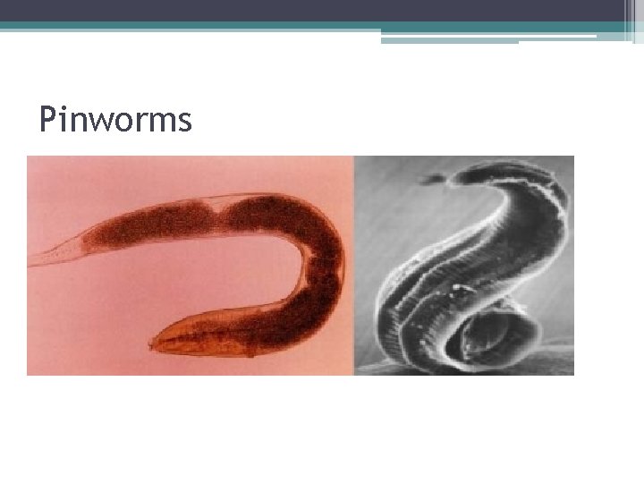Pinworms 