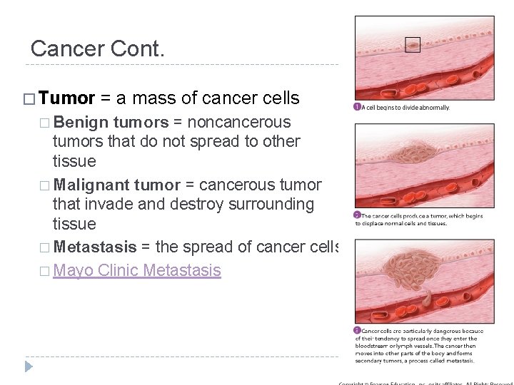 Cancer Cont. � Tumor = a mass of cancer cells � Benign tumors =