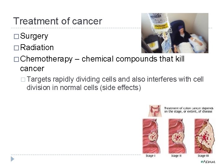 Treatment of cancer � Surgery � Radiation � Chemotherapy – chemical compounds that kill