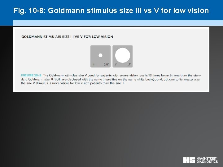 Fig. 10 -8: Goldmann stimulus size III vs V for low vision 