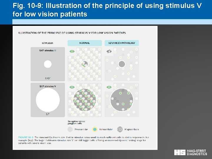 Fig. 10 -9: Illustration of the principle of using stimulus V for low vision