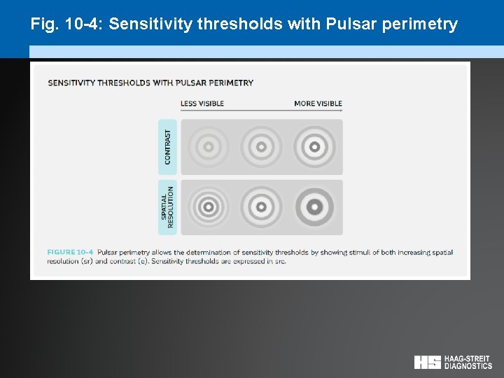 Fig. 10 -4: Sensitivity thresholds with Pulsar perimetry 
