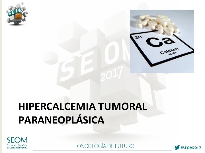 HIPERCALCEMIA TUMORAL PARANEOPLÁSICA #SEOM 2017 