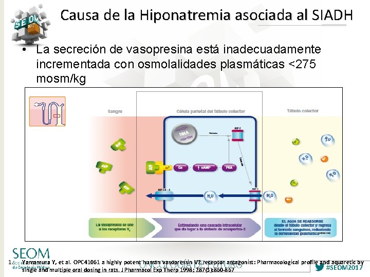 Causa de la Hiponatremia asociada al SIADH • La secreción de vasopresina está inadecuadamente