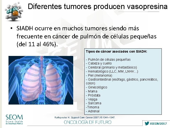 Diferentes tumores producen vasopresina • SIADH ocurre en muchos tumores siendo más frecuente en