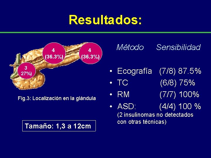 Resultados: 4 (36. 3%) Método 4 (36. 3%) 3 27%) Fig. 3: Localización en