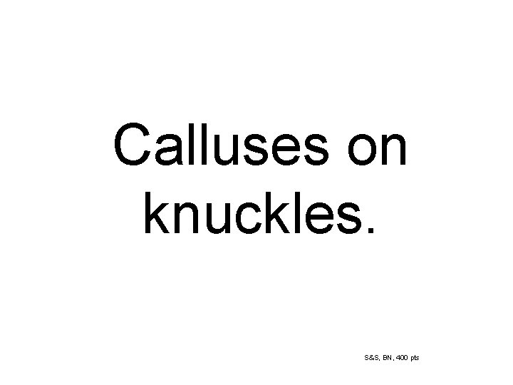 Calluses on knuckles. S&S, BN, 400 pts 