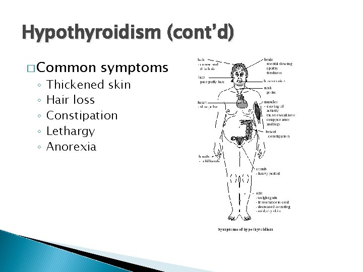 Hypothyroidism (cont’d) � Common ◦ ◦ ◦ symptoms Thickened skin Hair loss Constipation Lethargy