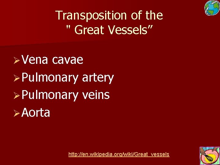 Transposition of the " Great Vessels” Ø Vena cavae Ø Pulmonary artery Ø Pulmonary