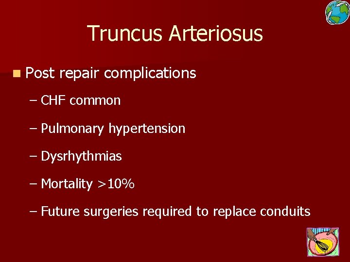Truncus Arteriosus n Post repair complications – CHF common – Pulmonary hypertension – Dysrhythmias
