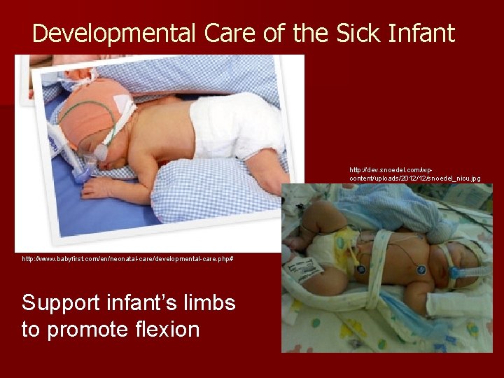 Developmental Care of the Sick Infant http: //dev. snoedel. com/wpcontent/uploads/2012/12/snoedel_nicu. jpg http: //www. babyfirst.