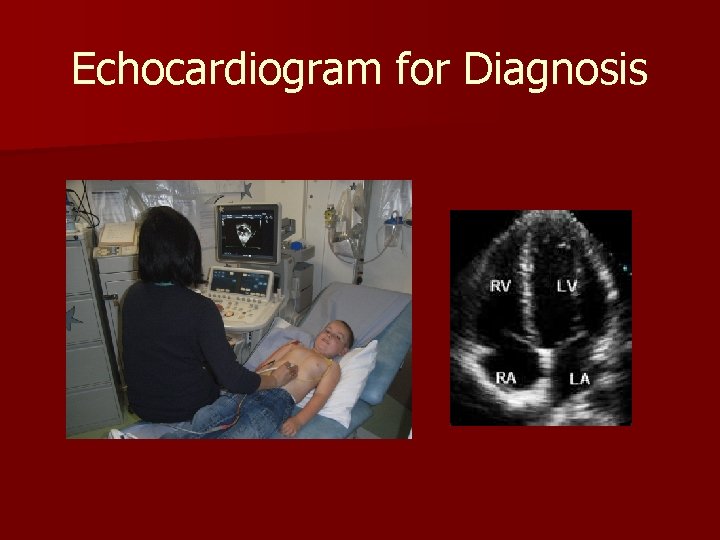 Echocardiogram for Diagnosis 