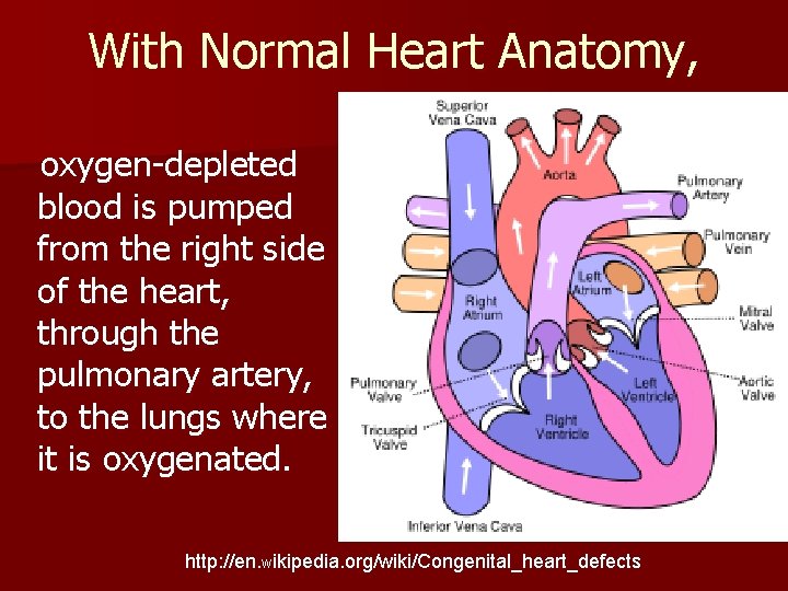 With Normal Heart Anatomy, oxygen-depleted blood is pumped from the right side of the