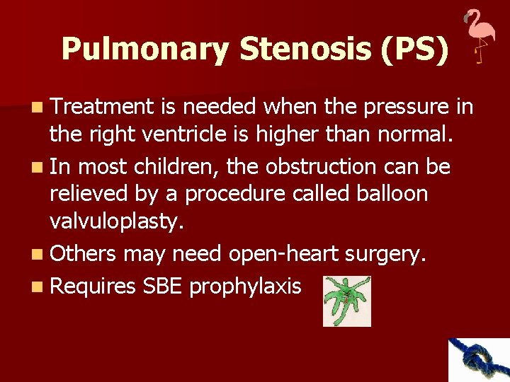 Pulmonary Stenosis (PS) n Treatment is needed when the pressure in the right ventricle