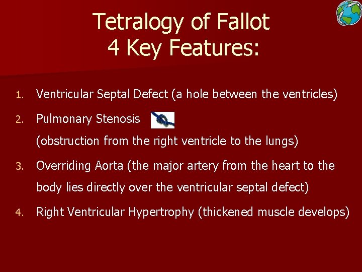 Tetralogy of Fallot 4 Key Features: 1. Ventricular Septal Defect (a hole between the