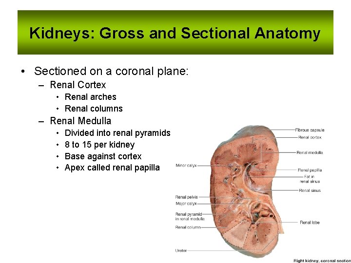 Kidneys: Gross and Sectional Anatomy • Sectioned on a coronal plane: – Renal Cortex