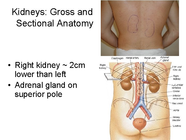 Kidneys: Gross and Sectional Anatomy • Right kidney ~ 2 cm lower than left