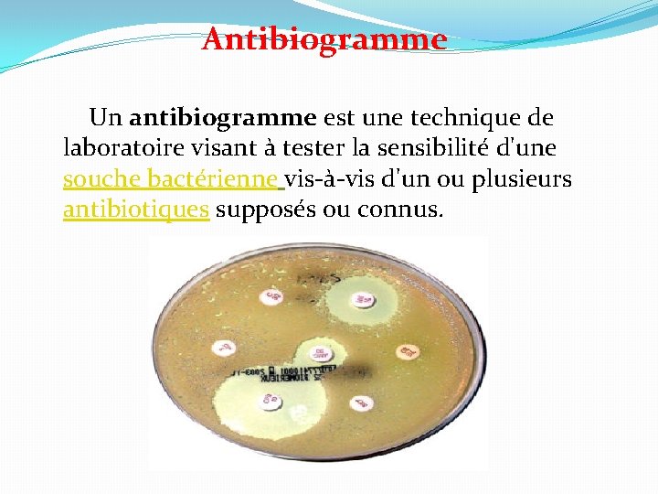 Antibiogramme Un antibiogramme est une technique de laboratoire visant à tester la sensibilité d'une