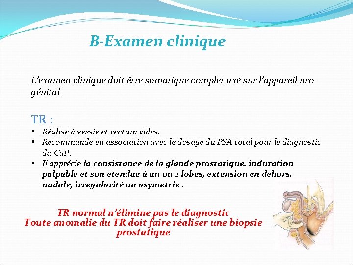 B-Examen clinique L’examen clinique doit être somatique complet axé sur l’appareil urogénital TR : B-Examen clinique L’examen clinique doit être somatique complet axé sur l’appareil urogénital TR :