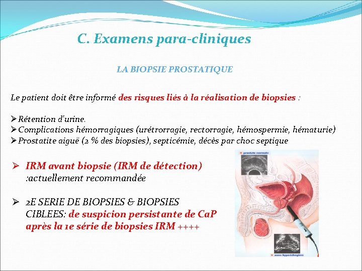 C. Examens para-cliniques LA BIOPSIE PROSTATIQUE Le patient doit être informé des risques liés C. Examens para-cliniques LA BIOPSIE PROSTATIQUE Le patient doit être informé des risques liés