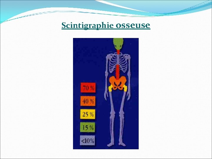 Scintigraphie osseuse Scintigraphie osseuse