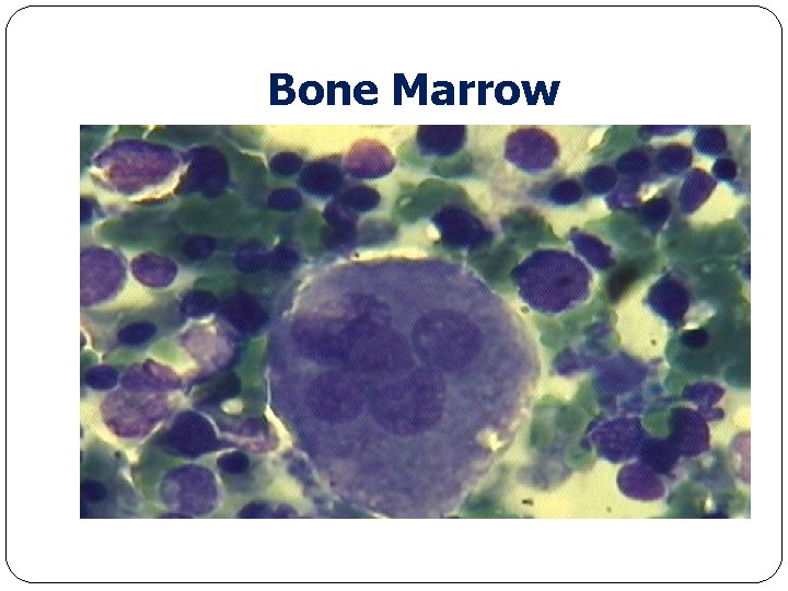 Bone Marrow 