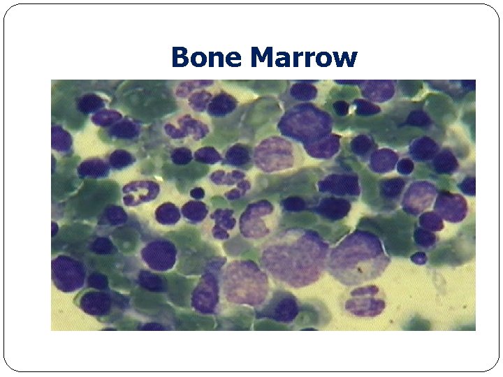 Bone Marrow 