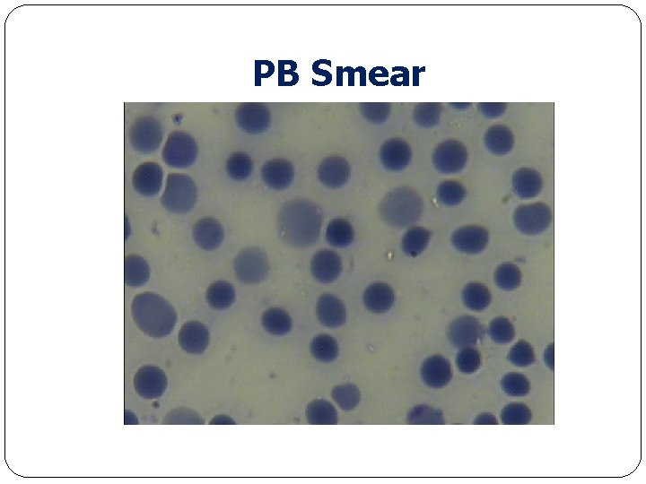 PB Smear 