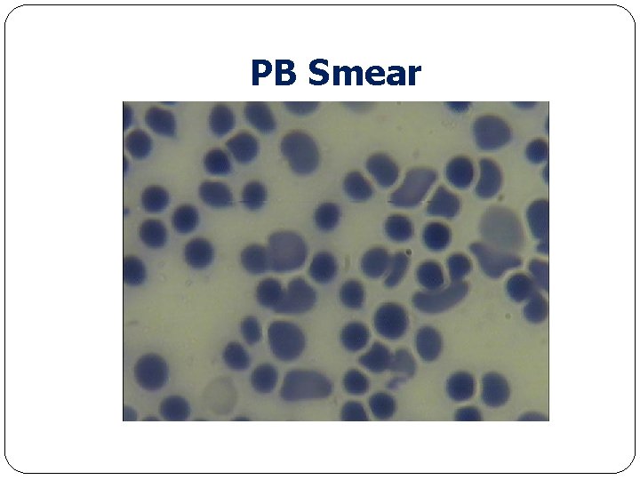 PB Smear 