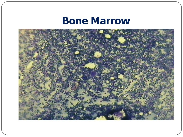 Bone Marrow 