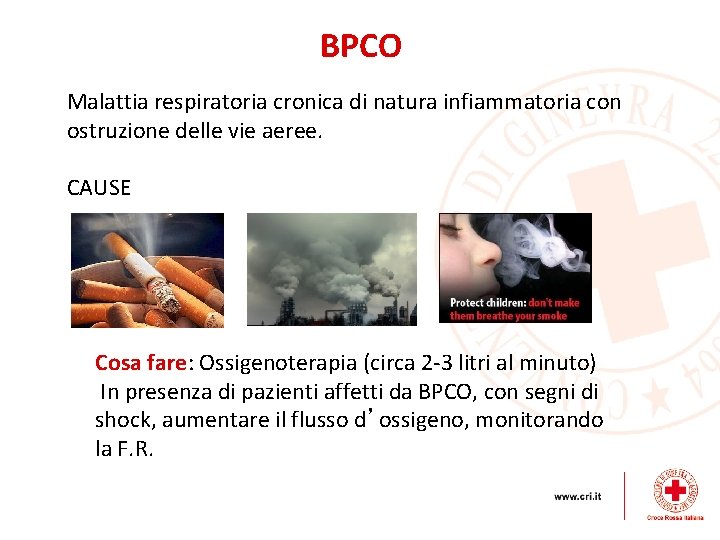 BPCO Malattia respiratoria cronica di natura infiammatoria con ostruzione delle vie aeree. CAUSE Cosa