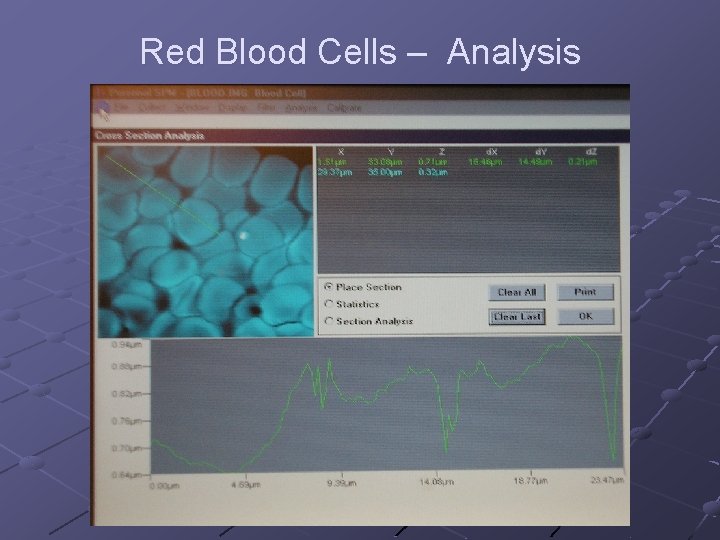 Red Blood Cells – Analysis 
