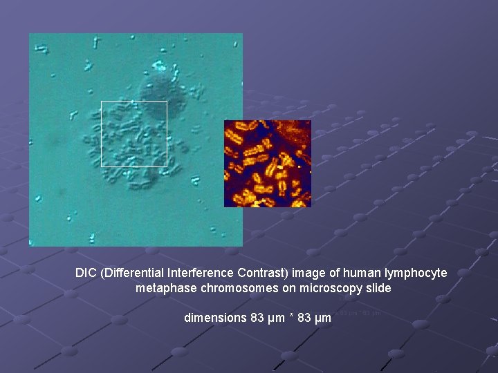  DIC (Differential Interference Contrast) image of human lymphocyte Contrast) image of human lymphocyte