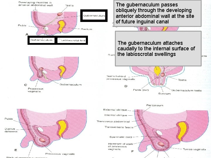 The gubernaculum passes obliquely through the developing anterior abdominal wall at the site of