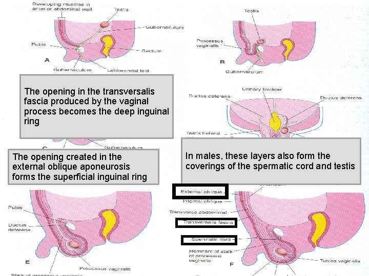 The opening in the transversalis fascia produced by the vaginal process becomes the deep