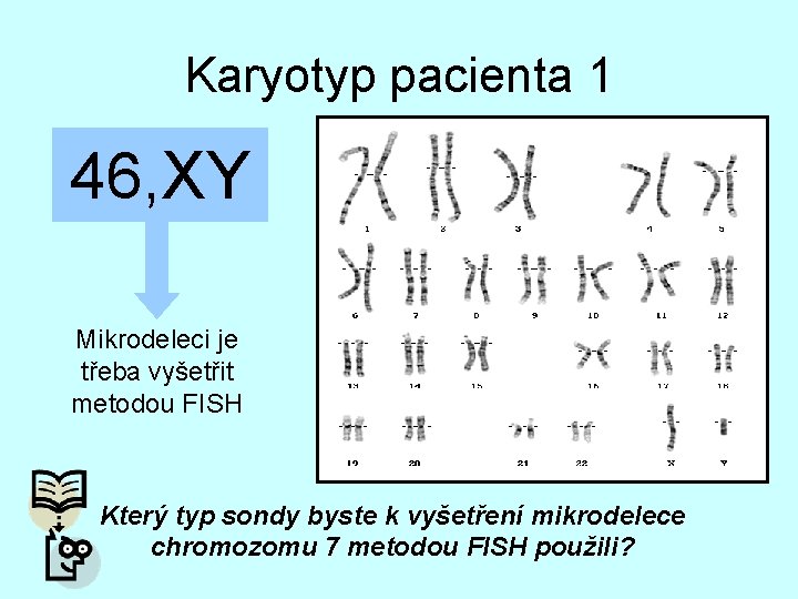 Karyotyp pacienta 1 46, XY Mikrodeleci je třeba vyšetřit metodou FISH Který typ sondy