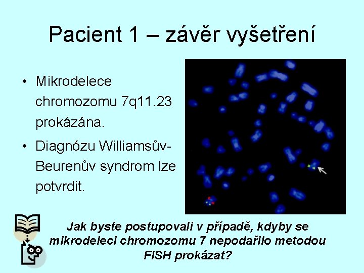 Pacient 1 – závěr vyšetření • Mikrodelece chromozomu 7 q 11. 23 prokázána. •