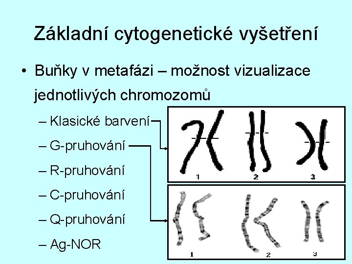 Základní cytogenetické vyšetření • Buňky v metafázi – možnost vizualizace jednotlivých chromozomů – Klasické