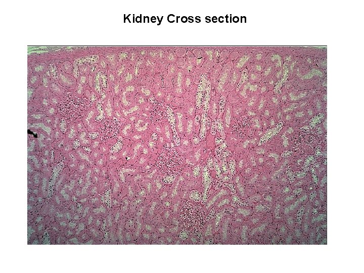 Kidney Cross section 