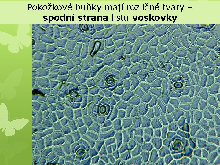 Pokožkové buňky mají rozličné tvary – spodní strana listu voskovky 