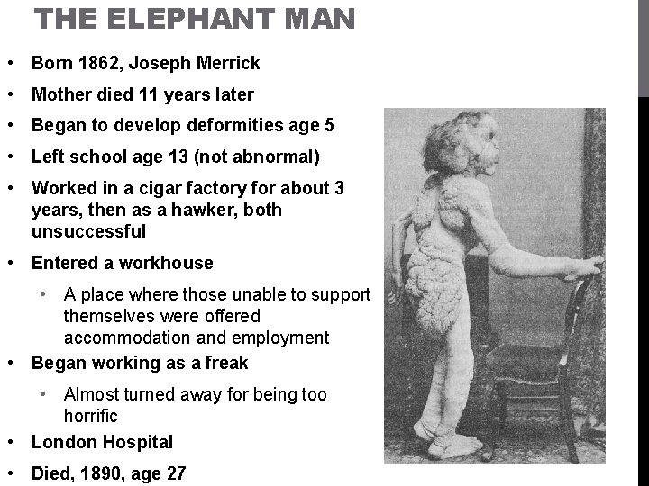 THE ELEPHANT MAN • Born 1862, Joseph Merrick • Mother died 11 years later