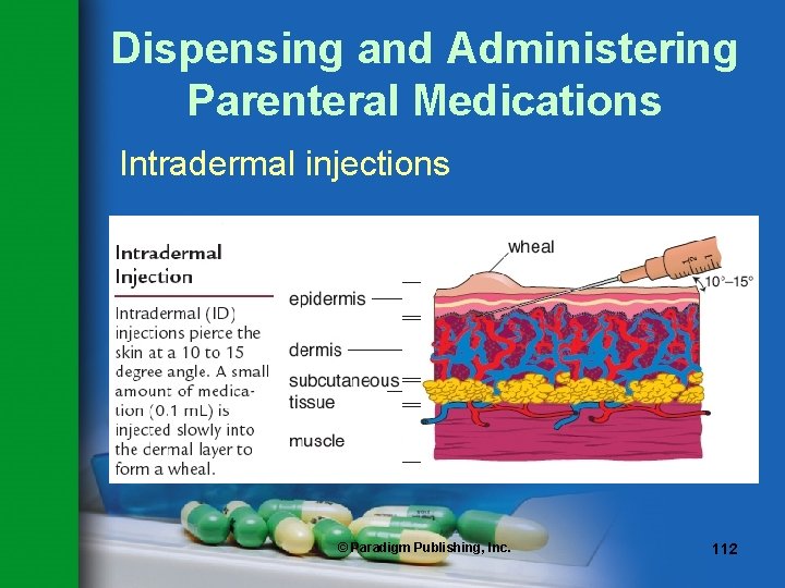 Dispensing and Administering Parenteral Medications Intradermal injections © Paradigm Publishing, Inc. 112 