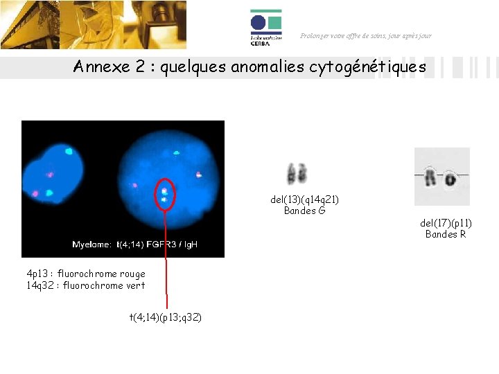 Prolonger votre offre de soins, jour après jour Annexe 2 : quelques anomalies cytogénétiques