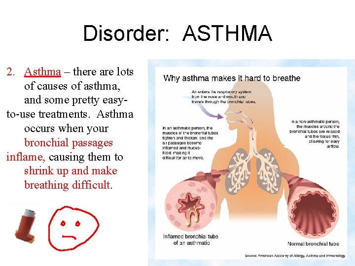 Disorder: ASTHMA 2. Asthma – there are lots of causes of asthma, and some