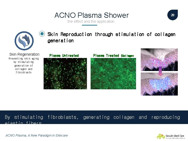 ACNO Plasma Shower 20 the effect and the application Skin Reproduction through stimulation of