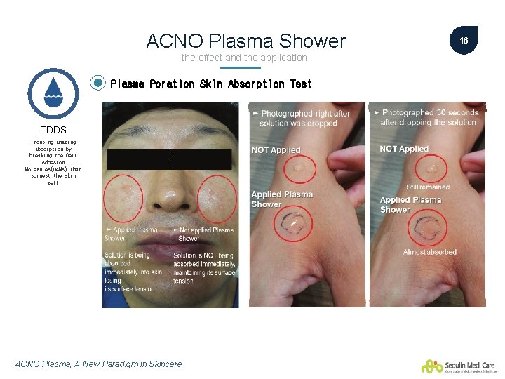 ACNO Plasma Shower the effect and the application Plasma Poration Skin Absorption Test TDDS