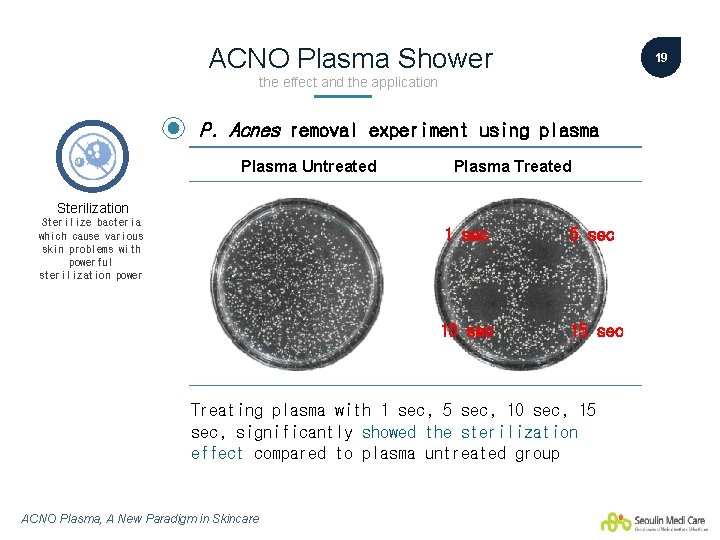 ACNO Plasma Shower 19 the effect and the application P. Acnes removal experiment using